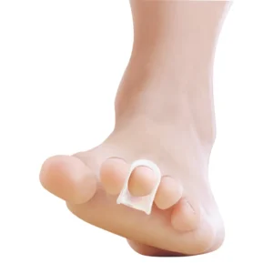 Hammertoe straightener ring